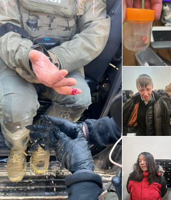 🇺🇸 Progresīvie ekstrēmisti nokoduši pirkstu vienam no robežsargiem, liecina foto pierādījumi. Iekšzemes drošības ministrija ziņo, ka pirksts nebūs glābjams. ASV robežsardzei uzbrūkošie deģenerāti un tos aizstāvošie lumpeņi apzināti netiek atspoguļoti kreisajā presē, lai parādītu