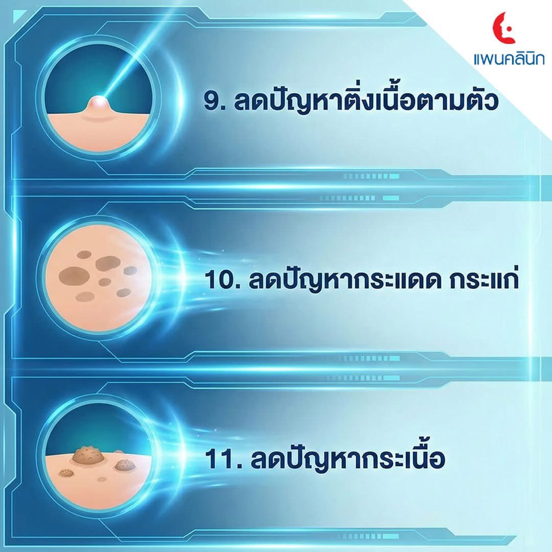 Panclinic's tweet photo. รวม 11 บริการดูแลปัญหาผิวแบบ Beauty Destination ที่ครบและครอบคลุมปัญหาผิว ไม่ด้วย Menu Destination โดยมีแผนการดูแล 12 สัปดาห์
.
พร้อมปรึกษาแพทย์ ทักแชทสอบถามรายละเอียดได้เลย
.
#Panclinic #PanClinicClub #แพนคลินิก #เพื่อนแพน #ปัญหาผิว #RealskinRealYou #BeautyDestinatio https://t.co/zE4QxL9fR1