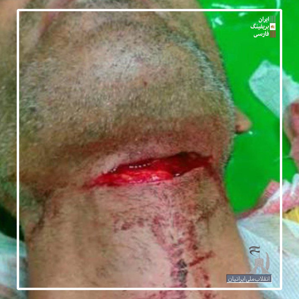 بریدن گلوی معترضین توسط نیروهای سپاه و بسیج،نشر بدین تا دنیا جنایت دیکتاتور قاتل رو ببینه