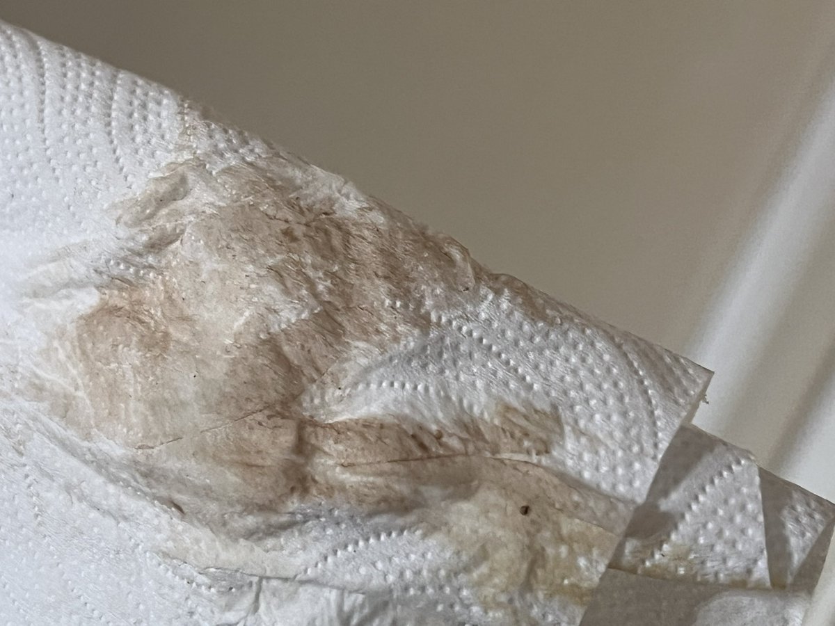 mursi73's tweet image. #Séptimo día de #regla,no he salido a comprar a la calle,llovió recién .