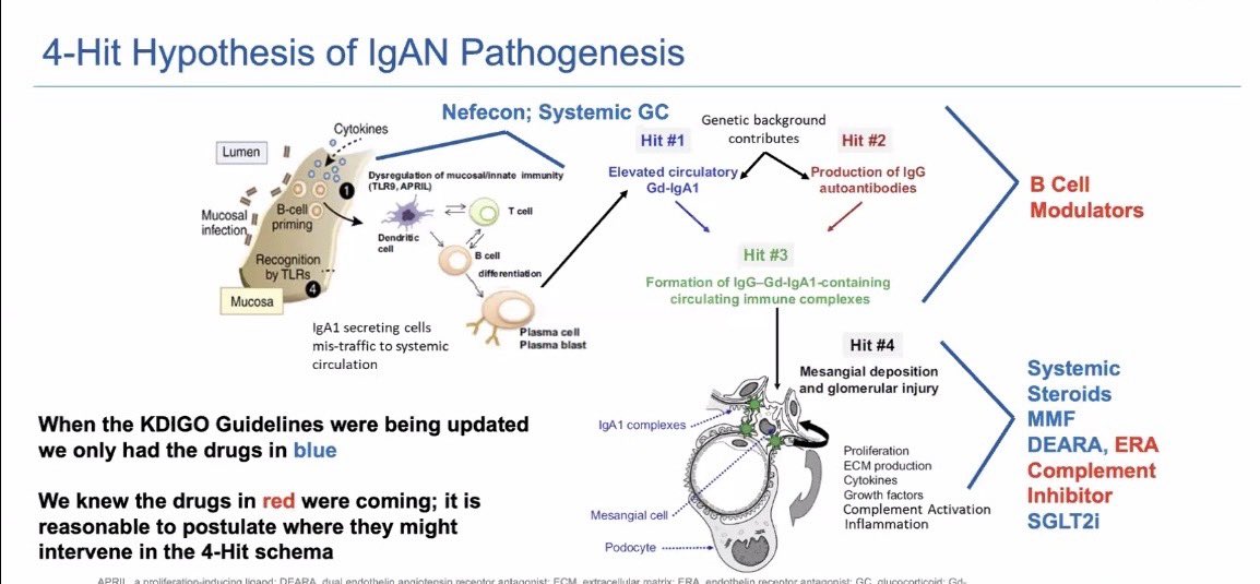 IzabelaZakrocka's tweet photo. Fantastic food for thought about so rapidly evolving diagnostic and therapeutic field in IgAN💊 thank you @SaynaNorouzi @BradRovin @GlomCon https://t.co/enKnalHlaW