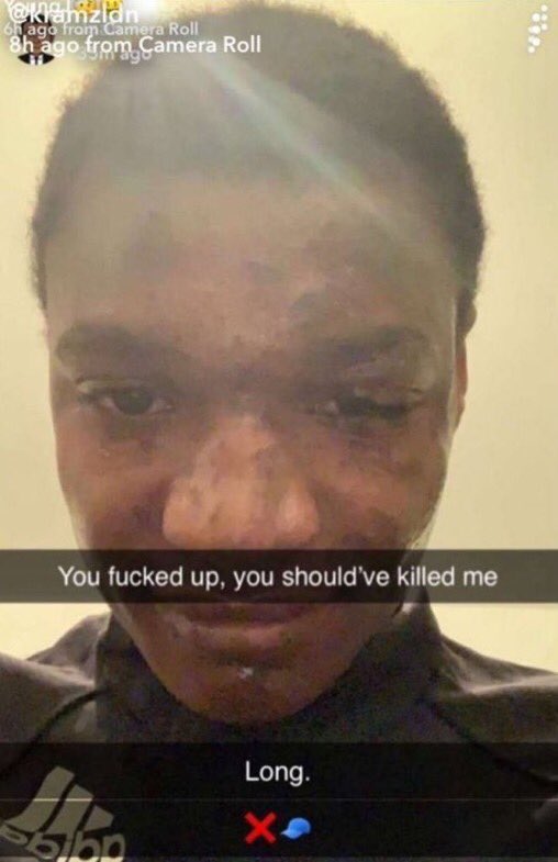 This dorgu revenge tour