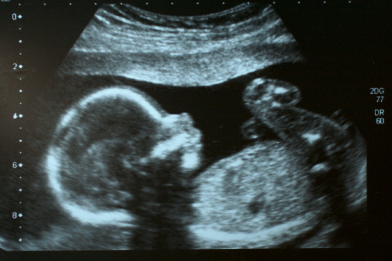LoisMcLatch's tweet photo. It’s nuts when women complain about not having “equal rights”

And what they mean is they don’t have the right to kill their children.

Men don’t have the right to kill either 🤷🏻‍♀️ https://t.co/GNwNnk5mJo