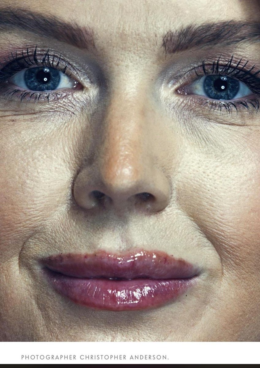 CorrectionGreat's tweet photo. @itsrosesm If you like needle holes in lips, yes!!!
🤮🤮🤮 https://t.co/FkVDPIfCFK