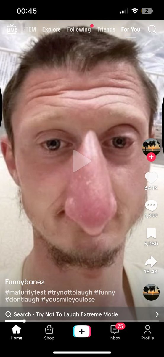 Alex gappy has signed a three year contract with fc stompin as the clubs social media influencer. He told slowteesnews “ if you ain’t in sinners on a Friday then where the fuck you at “ we are absolutely not buzzing to have Alex on board and cant wait to get started.