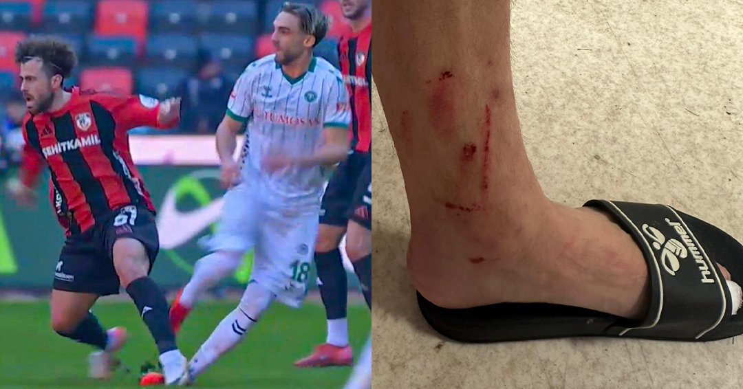 𝐊𝐀𝐌𝐔𝐎𝐘𝐔𝐍𝐀 𝐕𝐄 𝐘𝐄𝐓𝐊𝐢𝐋𝐢 𝐌𝐄𝐑𝐂𝐢𝐋𝐄𝐑𝐄 𝐃𝐔𝐘𝐔𝐑𝐔

Gaziantep FK ile oynadığımız müsabakada futbolcumuz Berkan Kutlu’nun, rakip oyuncu Ogün Özçiçek tarafından maruz bırakıldığı müdahale, yalnızca faul değil; oyuncu sağlığını tehlikeye atan, kontrolsüz ve sert