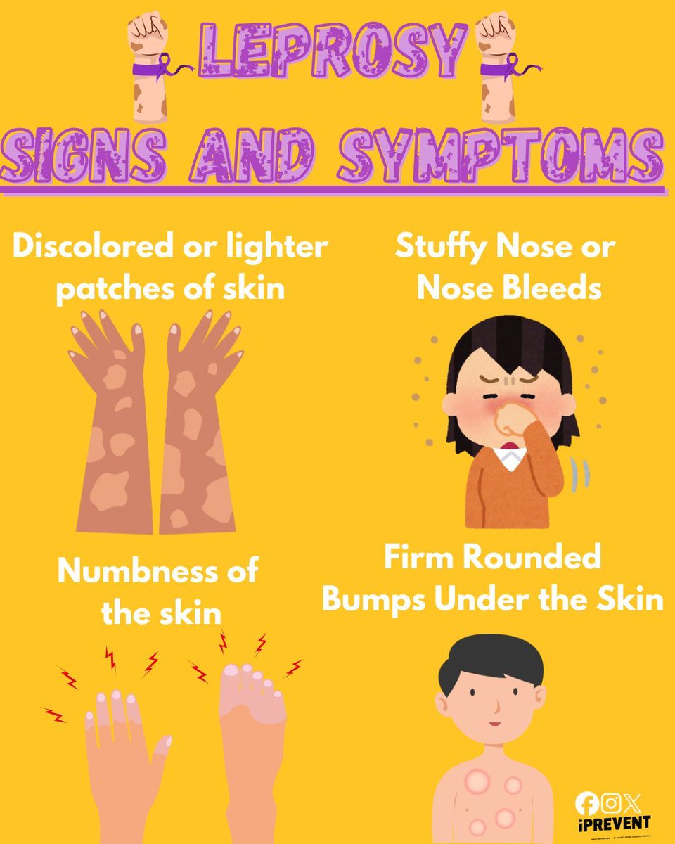 iPrevent_OHL's tweet image. World Leprosy Day highlights how education, early detection, treatment, and stigma reduction save lives. Know the signs: discolored skin patches with numbness, tingling in hands/feet, nose issues, or firm round bumps under the skin.
Learn more: cdc.gov/leprosy
#iPrevent