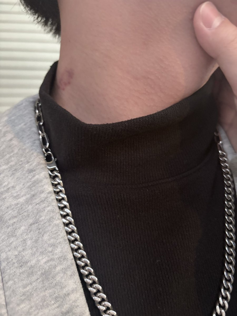 種了一座草莓園給高領小狗
衣服甚至昨天我挖到叫他穿的幹我真的瘋掉謝謝50% https://t.co/W9fZkxW5UH