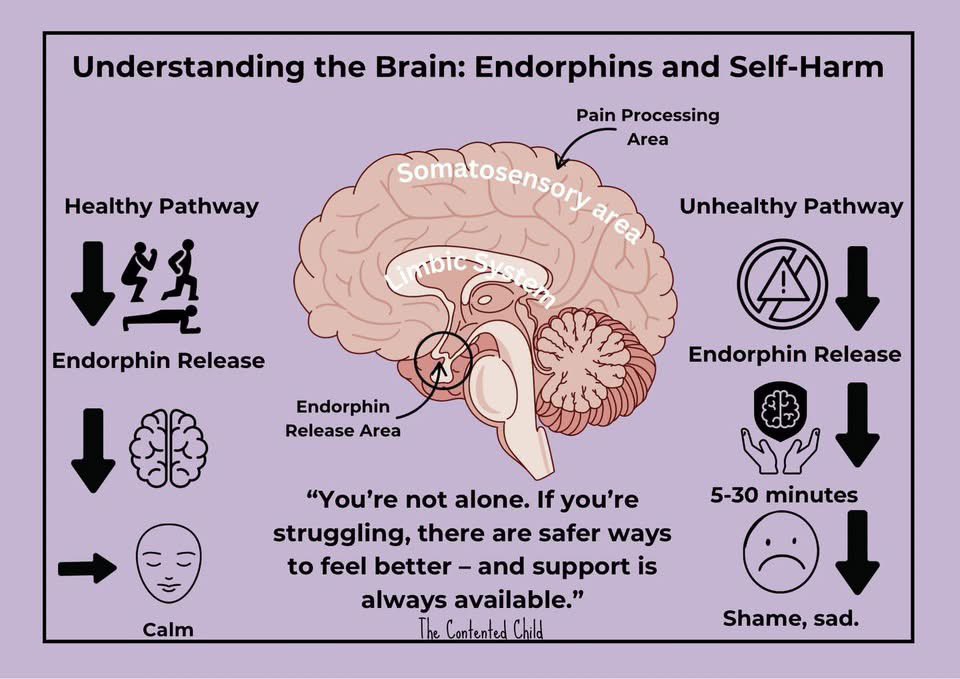 chronicpsycho_'s tweet image. “why do people even self harm?”

well i guess it’s usually a coping mechanism.
from underlying trauma and overlapping mental illness, and stressors from the events life throws at you.

it can turn into addiction.
there is a science behind it.

think twice before you judge.