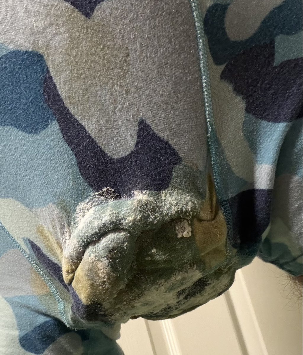 undiespiler711's tweet photo. I’m at 6/10, I’m almost there ngl, I plan to mess twice a day so I can reach my goal of 10 loads earlier #gayscat #poopingunderwear #underwearshit #soiling #messing #hypermessing #pantspoop #stainedundies #multiload #part6 https://t.co/9KwxdgkPNr