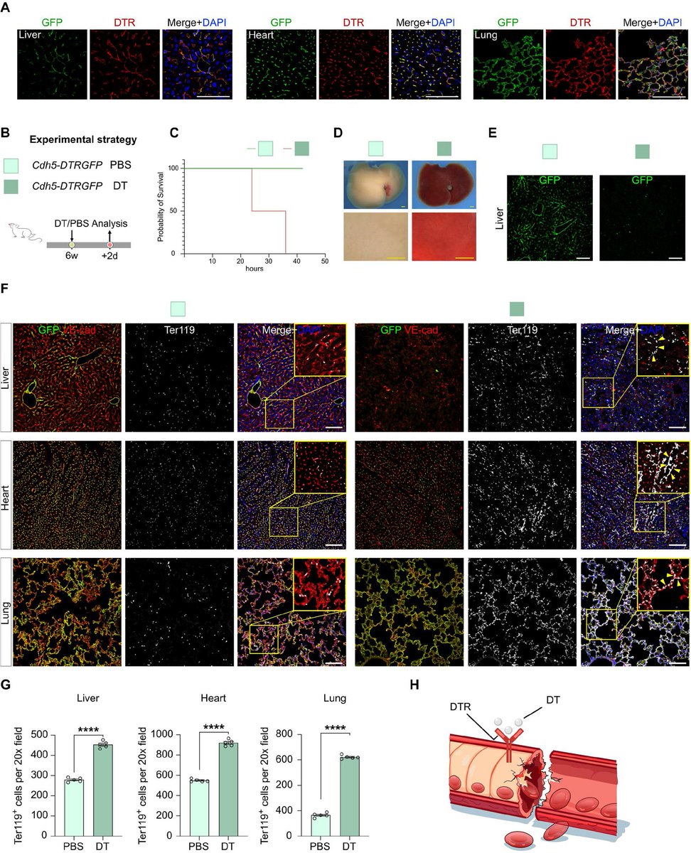 Cell Regen Research | A new mouse model for precise endothelial cell ablation! 🩸Dual Cre/Dre logic activates DTR for precise vascular studies.
#EndothelialCells #GeneEditing
🔗 Full paper at: doi.org/10.1186/s13619…