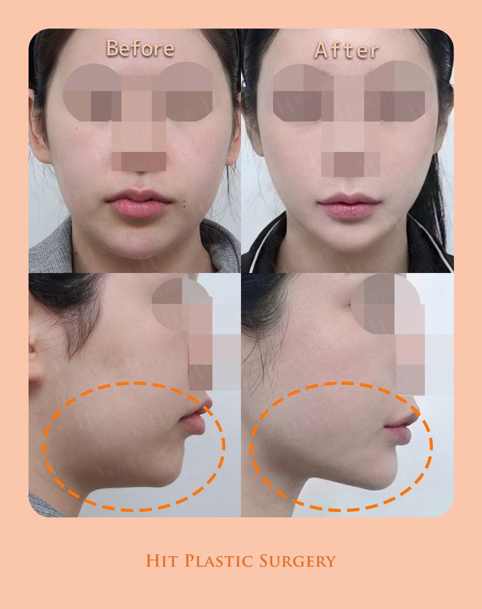 ヒット整形外科 tweet media