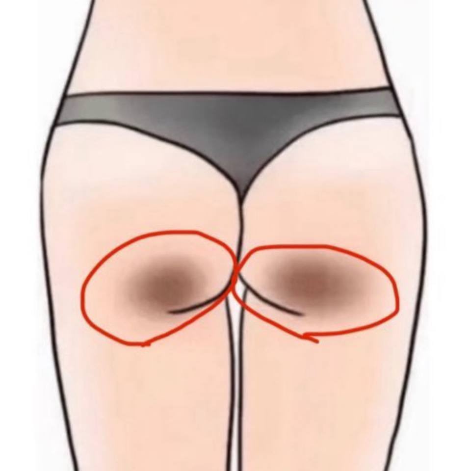 roselymarchela's tweet image. i want to share thiss WOEE 😭 powerful BANGET aha lotion teratu. aslii wajib punyaaa, kepake dari selangkangan, ketek, siku, lutut sampe muka 😭👍🏻

bener2 kepake buat jangka panjang karena fungsinya banyak banget… satu produk, banyak area 👌🏻