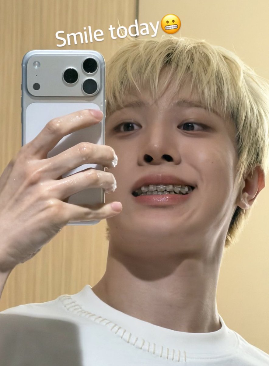 Hajunpfk's tweet image. วัยรุ่นฟันเหล็กว่ะ😬😬