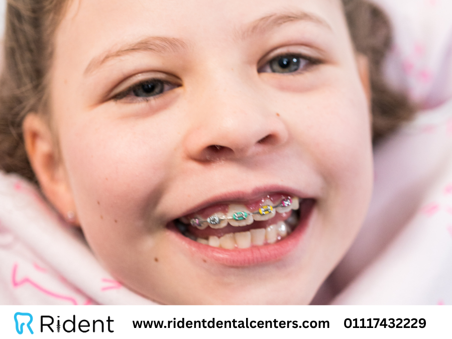 تقويم الأسنان للأطفال… قرار ذكي بدري

تقويم الأسنان مش بس ابتسامة أحلى،
ده بيساعد على تصحيح وضع الأسنان والفك ويقلل مشاكل مستقبلية.
 السن المناسب يبدأ من بدري علشان نتائج أسرع وأفضل.

 اقرأ المقال واعرف كل التفاصيل

rebrand.ly/hjdjhtx