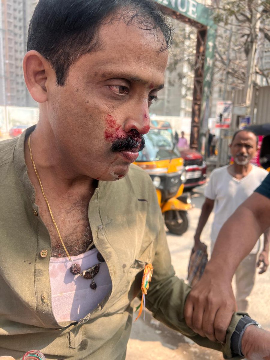 pkvaranasi's tweet photo. Serious condemnable physical act by some rowdies on #TeNA @TellapurN President today in #OsmanNagar in presence of #Kollur Police, Request @TelanganaDGP to act on this and prevail Justice. @revanth_anumula @KTRBRS https://t.co/U17VgIQsmA