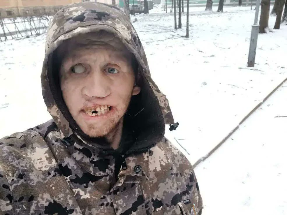 frontlinekit's tweet image. 🇷🇺 russian soldier takes a selfie while trying to occupy Ukrainian land.

You understand now why we call them orcs?