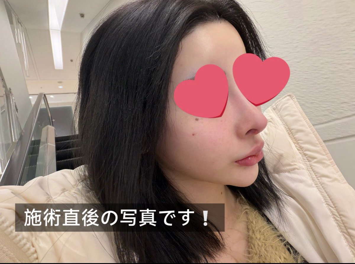 め tweet media
