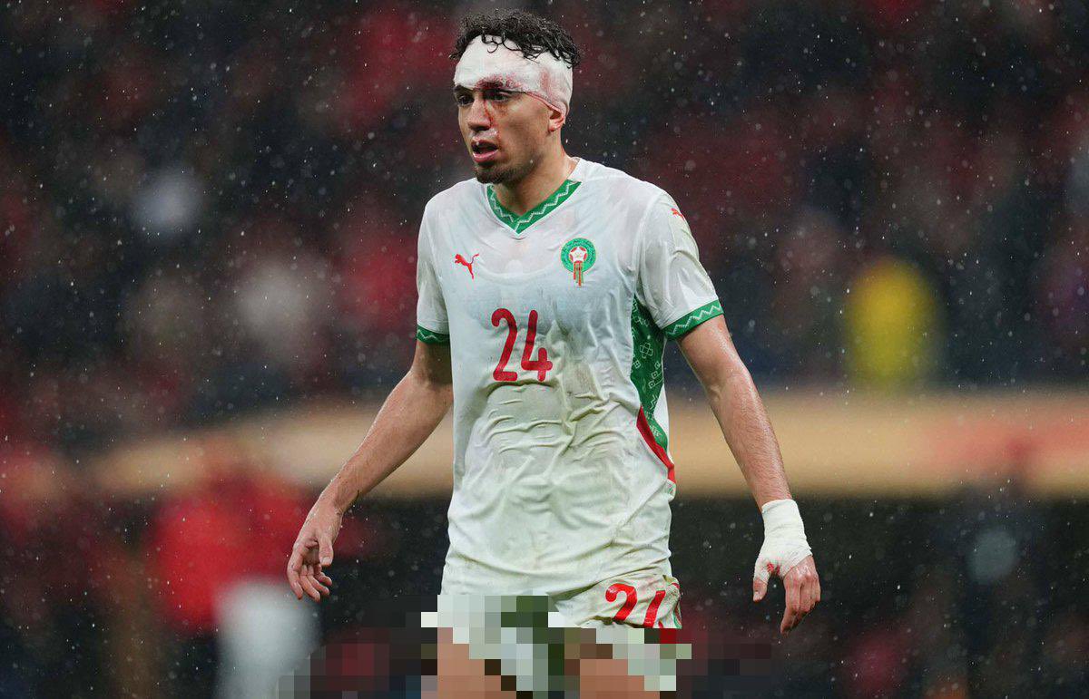 ilyeskddr's tweet photo. Ton maillot a été taché de boue, de sueur et même de sang, mais jamais de honte. https://t.co/KMP8HzHLt9