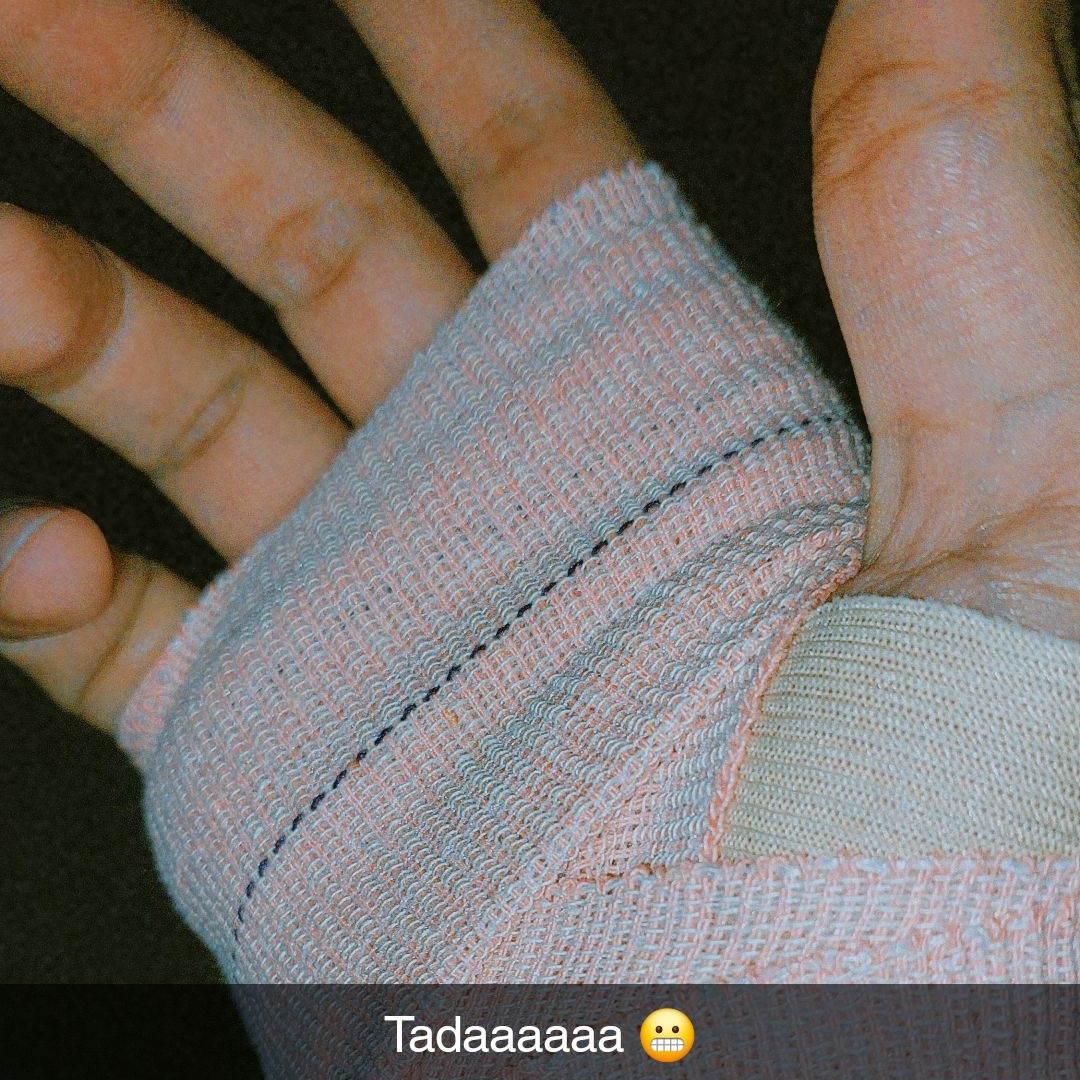 brown_pakora's tweet photo. A proper injury after a really long time.
Will get back stronger 💪🏻 https://t.co/oTpOMeadxB
