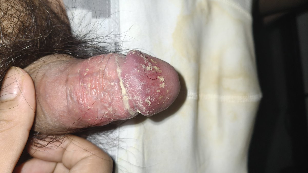 成都雄臭S tweet media