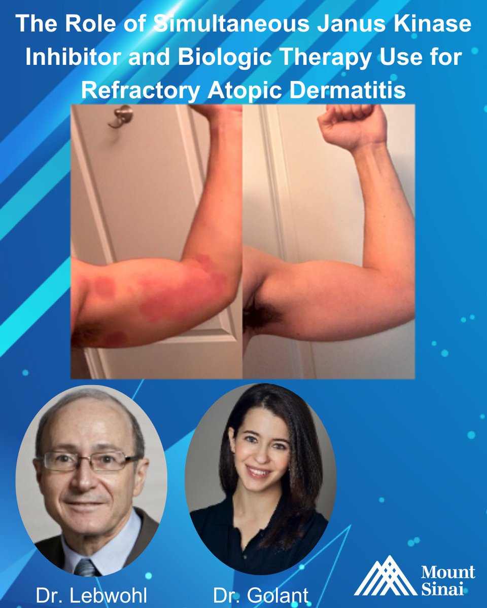 Mount Sinai Dermatology tweet media