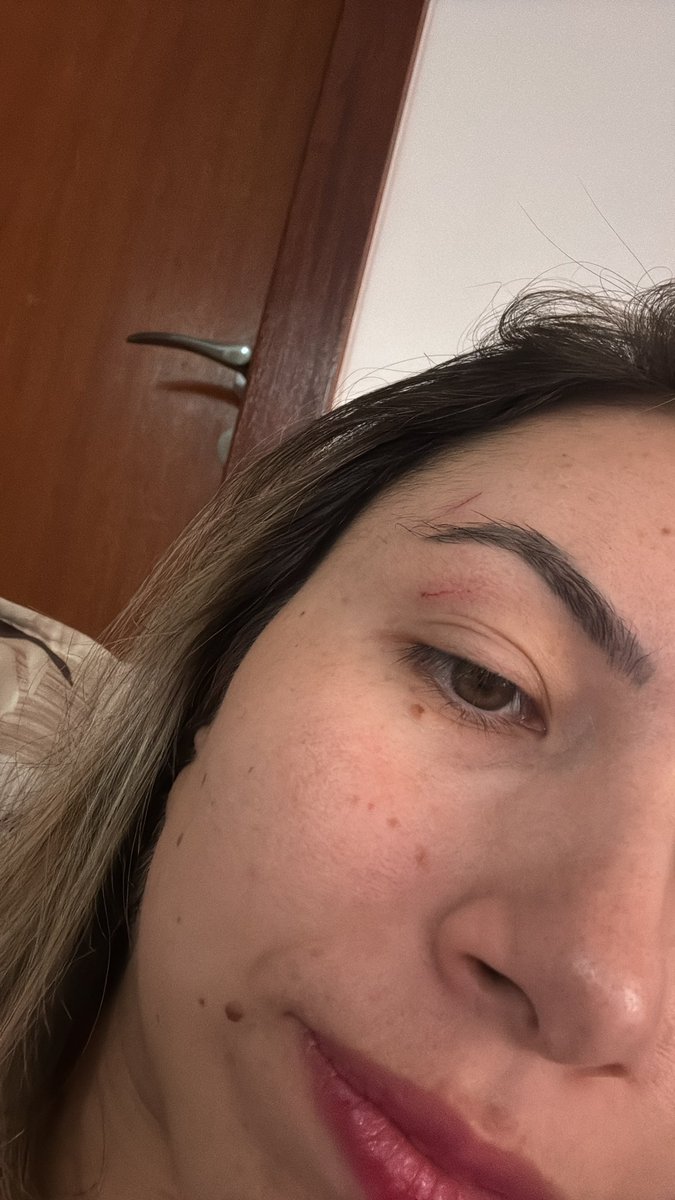 gleisa_a's tweet photo. e minha gata arranhou meu olho https://t.co/XRLT0zeiWf