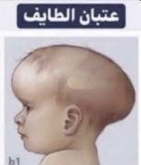 ياسر tweet media