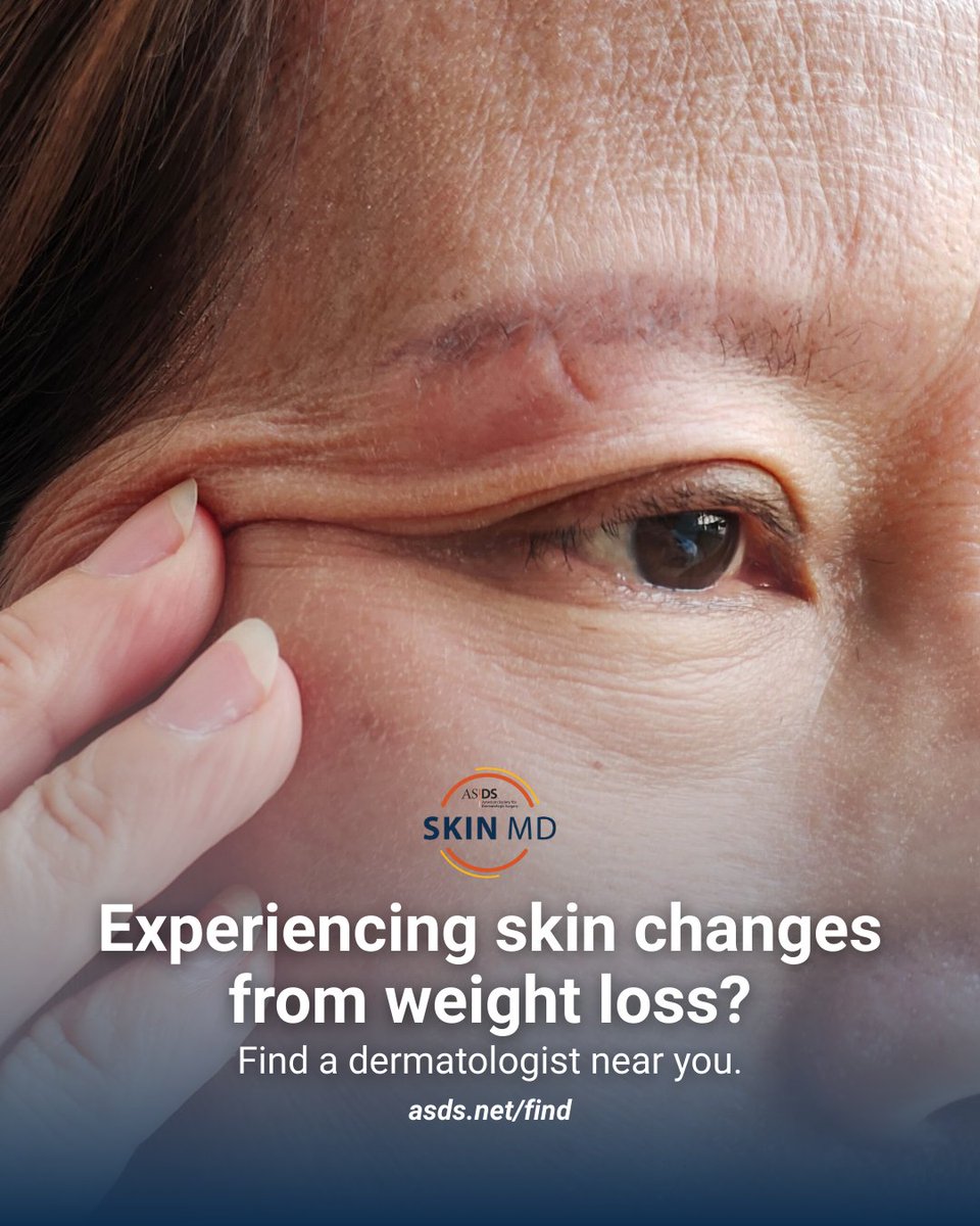 ASDS Skin MD tweet media