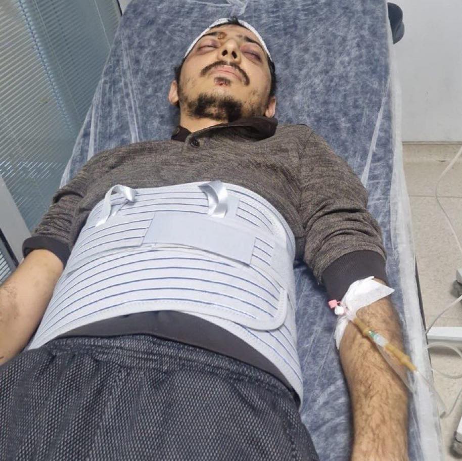 Nusaybin'de Türk Bayrağını indiren PKK’lı cezaevinde beyin kanaması geçirdi. Şahıs hastaneye sevk edildi.