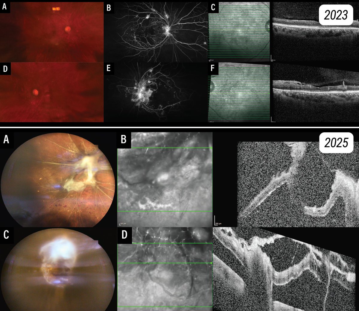 Retina Specialist tweet media