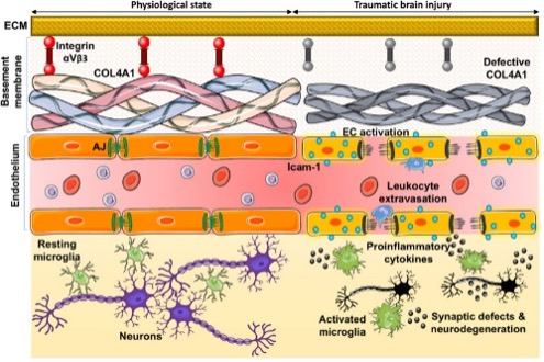 NEIDirector's tweet photo. New #NIHFunded research suggests stem cell-conditioned medium may help repair retinal damage after brain injury. Findings highlight a potential path to protect vision following neurotrauma. 
@uthsc @VanderbiltU  
@SpringerNature paper: https://t.co/MWyZFUOvNy https://t.co/Cj2zi4cBzl