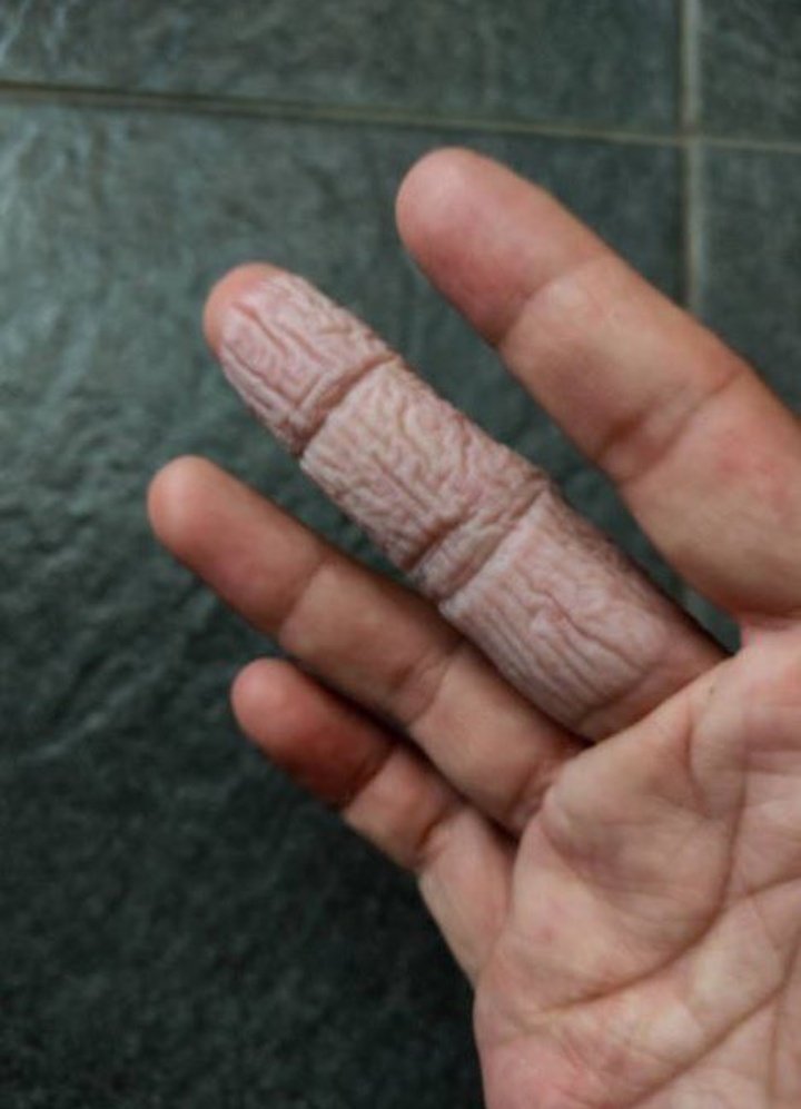 What is the cause of this? 🤔