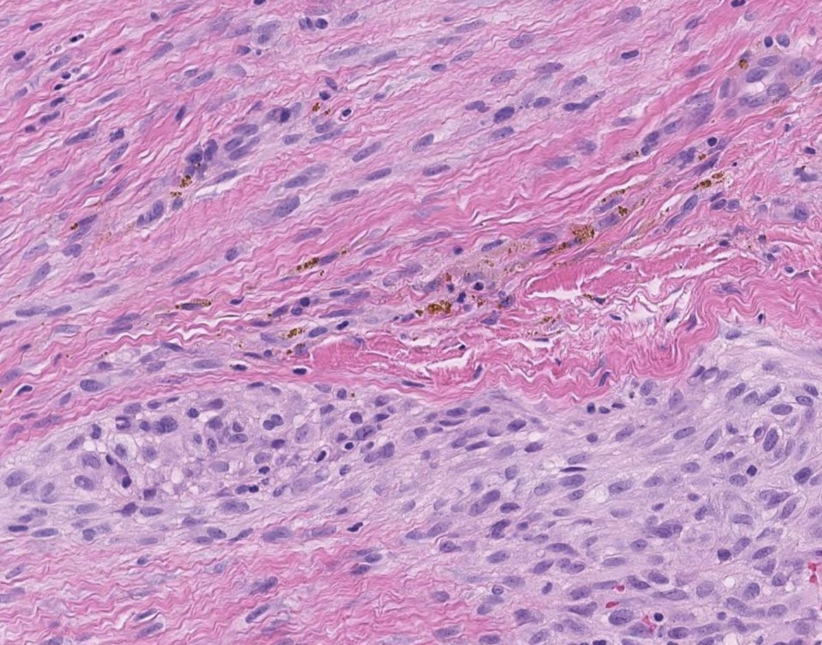 Toby Schmitt, MD tweet media