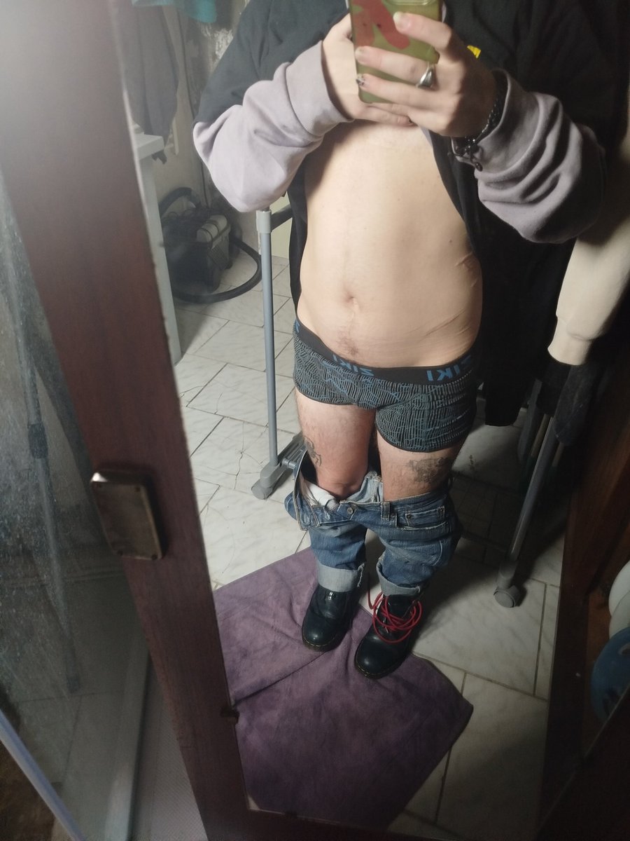 RottingFinn's tweet photo. What 4months inpatient did to me 🫩 https://t.co/NFJGoDfuL0
