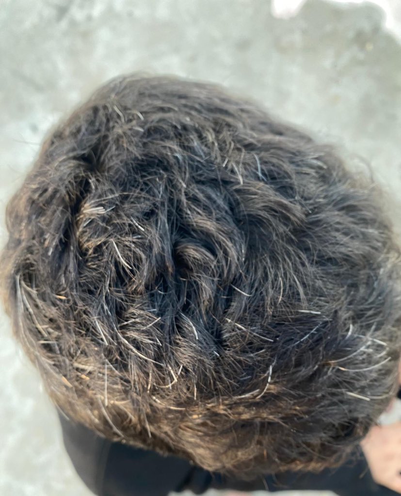 The campaign I created to evacuate my brother Amir and get him medical treatment is receiving donations very slowly.

Amir’s condition is getting worse day after day, and the ongoing bombardment is making his situation even more critical.

There is news about the Rafah crossing