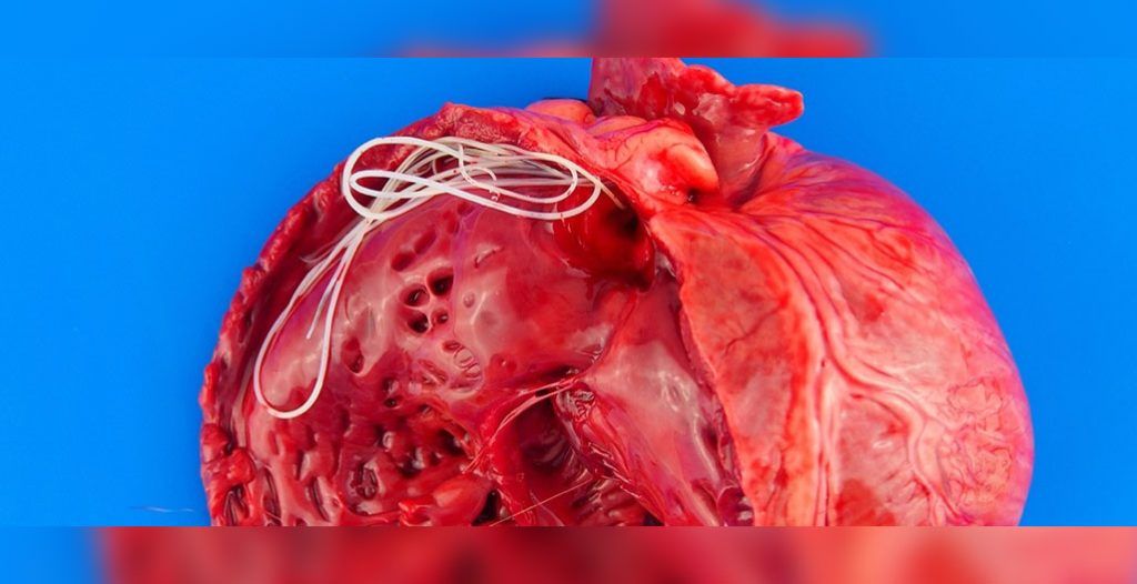 The history of dog heartworm may be more complex than we thought. Discover the key players shaping regional heartworm populations. veterinarypracticenews.ca/study-uncovers…