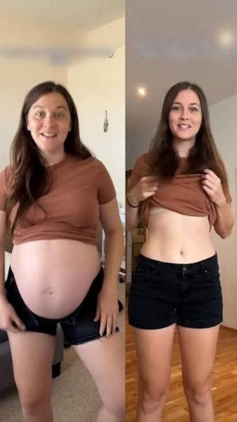 Justin21604067's tweet photo. @khal_juniier Also women you have nothing to worry about from a medical standpoint it would be rare for it to deteriorate you that much. This is a picture of what the average woman would probably go through. https://t.co/BzY646hBg6