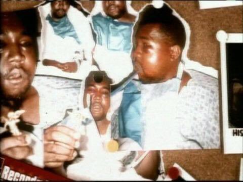 yeunrlsd's tweet image. People underestimate how bad Ye’s car crash and his condition after was.