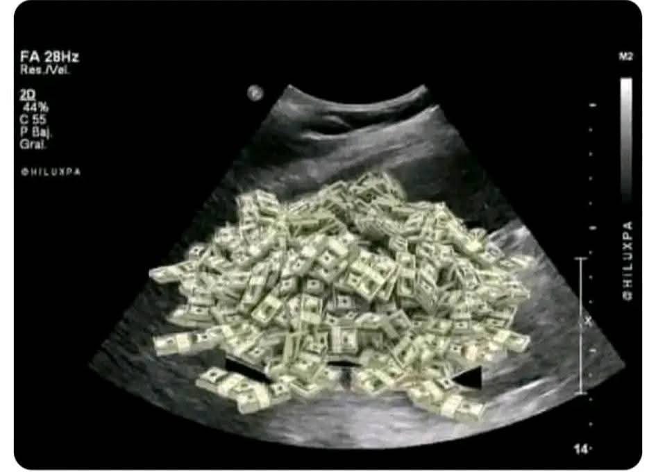 La única bendición que quiero: