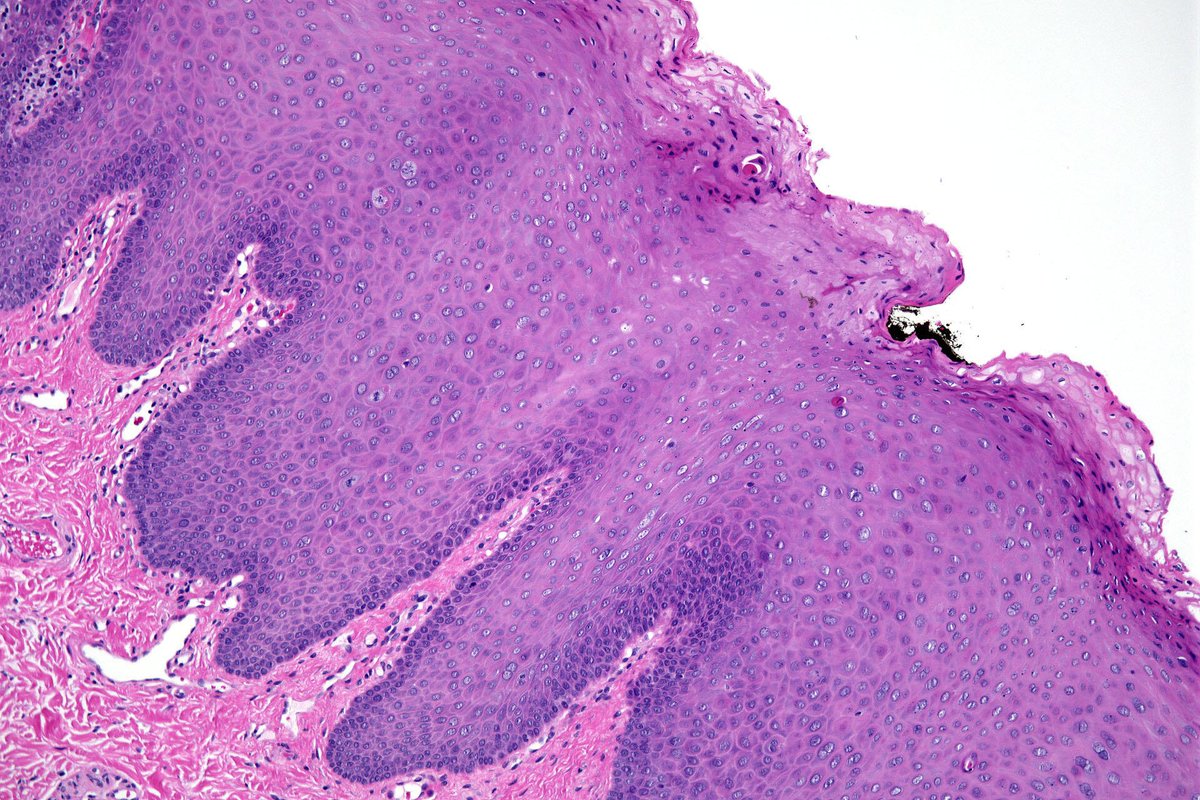 Hassan Khormi tweet media