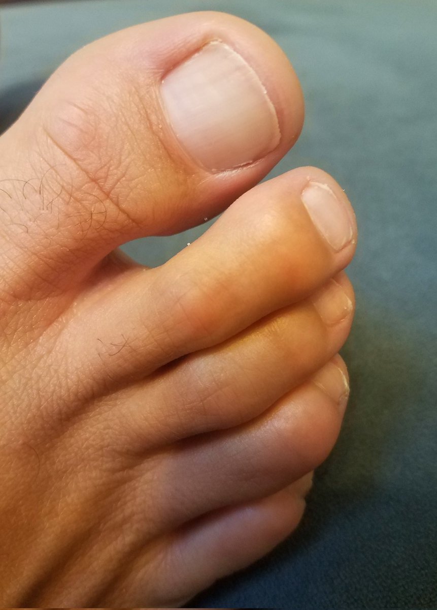 @FootGuy1969 tweet media