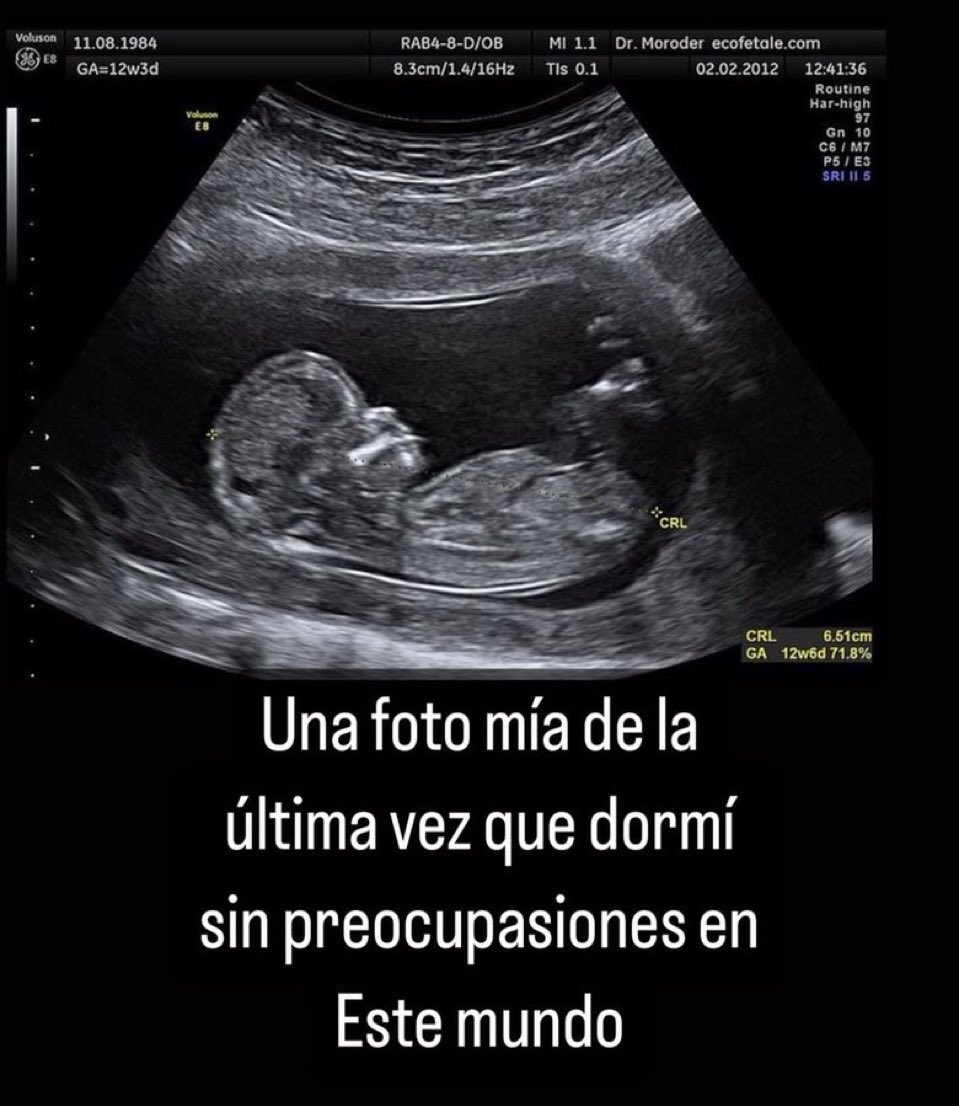 Javisness's tweet image. 