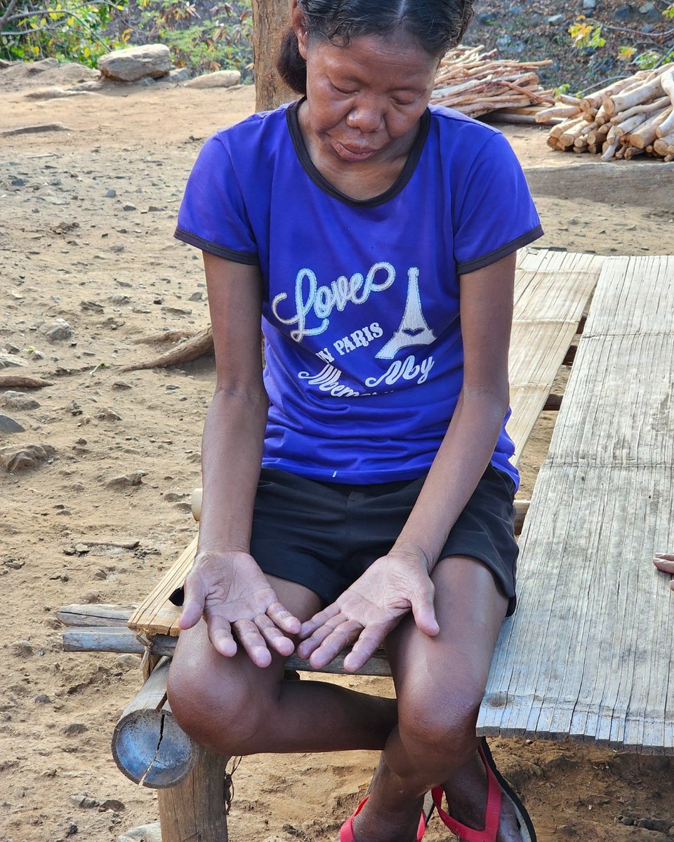 Leprosy Mission Australia tweet media