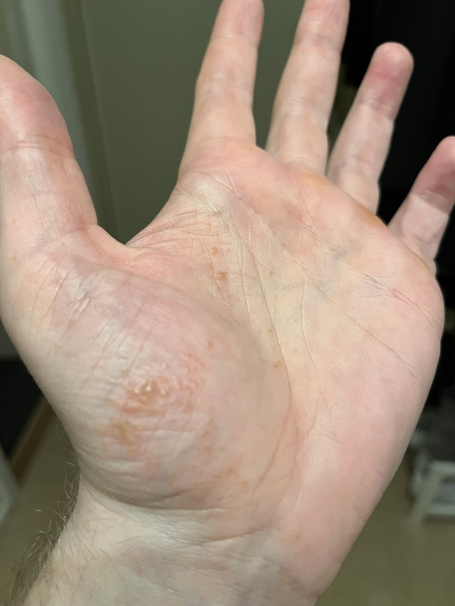 KungenTV tweet media