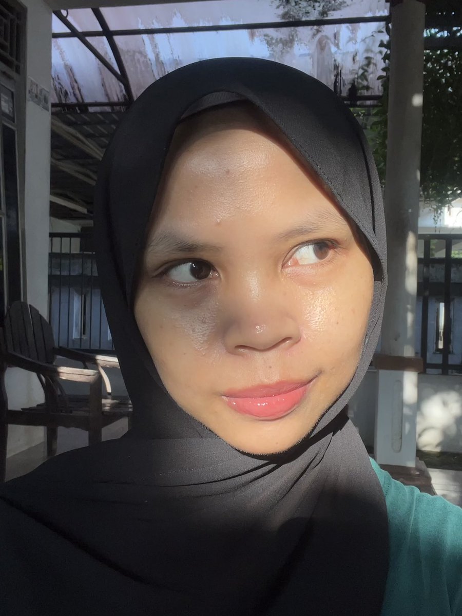 archqry's tweet image. what a PEPTIDE serum actually did to my skin after using it in my night routine 👀