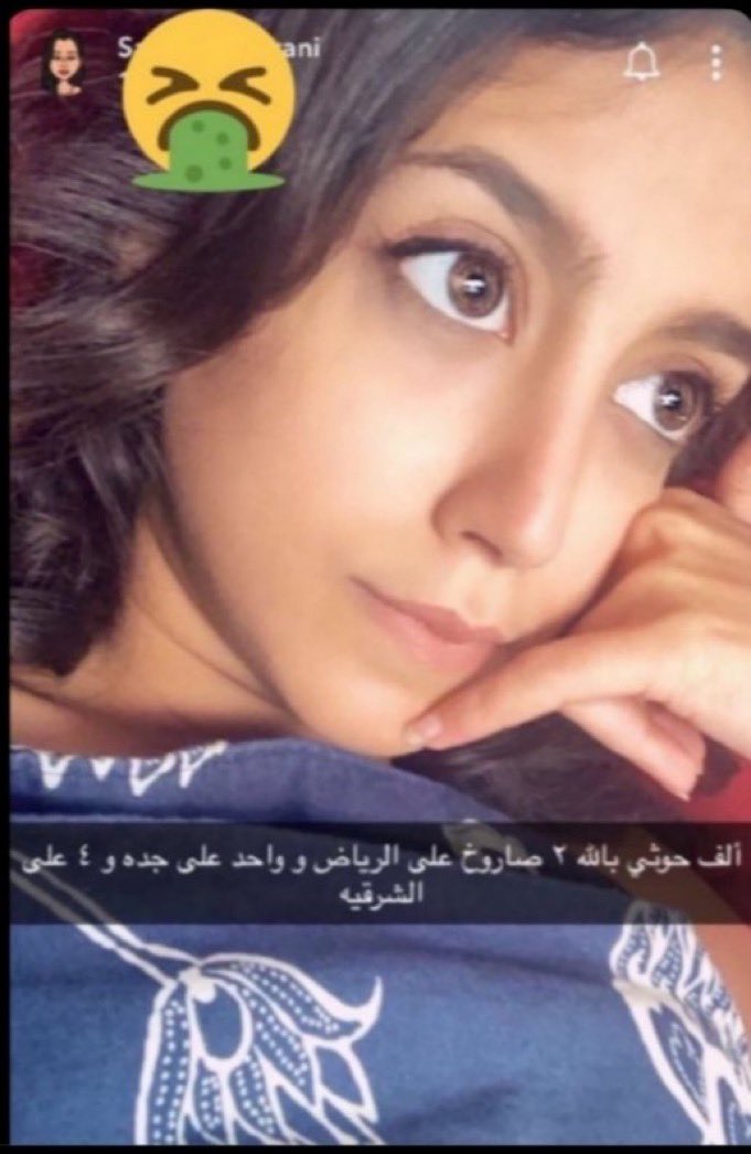Klax_10's tweet photo. ماشاف ذولي
هذا لو يشوف حقد السعوديات بيعرف انهم اىْجS نساء العالم 
عايشات بعز وطمأنينه بفضل الله ثم السعودي واخرتها جحدوه
ذولي بس لو يعيشون زي ماعاشوا اليمنيات والسوريات والفلسطينيات والسودانيات بيعرفون فضل السعودي عليهم
لكن التعوسيه مخلوق طفيلي نتن مامنه فايده https://t.co/z5DvYVenEX