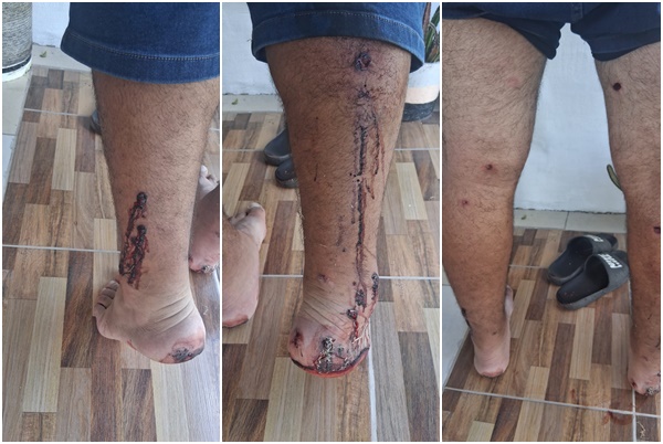 Violenta represión en el puerto de Concepción del Uruguay: estibadores denuncian un operativo ordenado por la Fiscalía en pleno conflicto laboral radio10mardelplata.com.ar/violenta-repre… a través de @Radio 10  Mar del Plata FM 105.5 / Miramar 101.7 / Balcarce