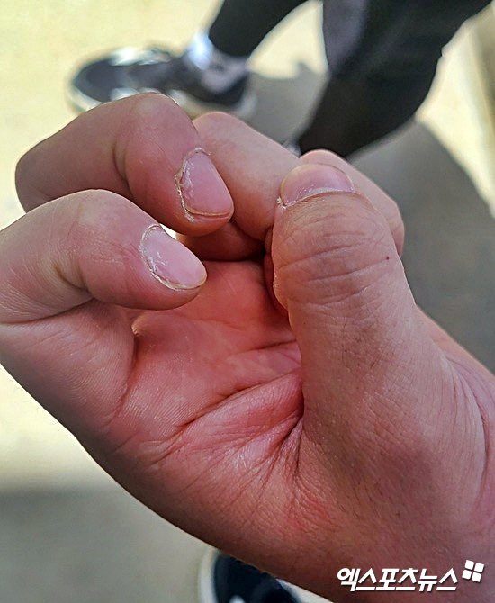 비시즌 동안 손 관리에 집중했다. 비오틴(영양제)도 챙겨 먹고, 큐티클 오일과 핸드크림을 자주 바르면서 손톱을 최대한 건강하게 유지하려고 노력했다

이게 투수 비시즌이야 손모델시즌이야