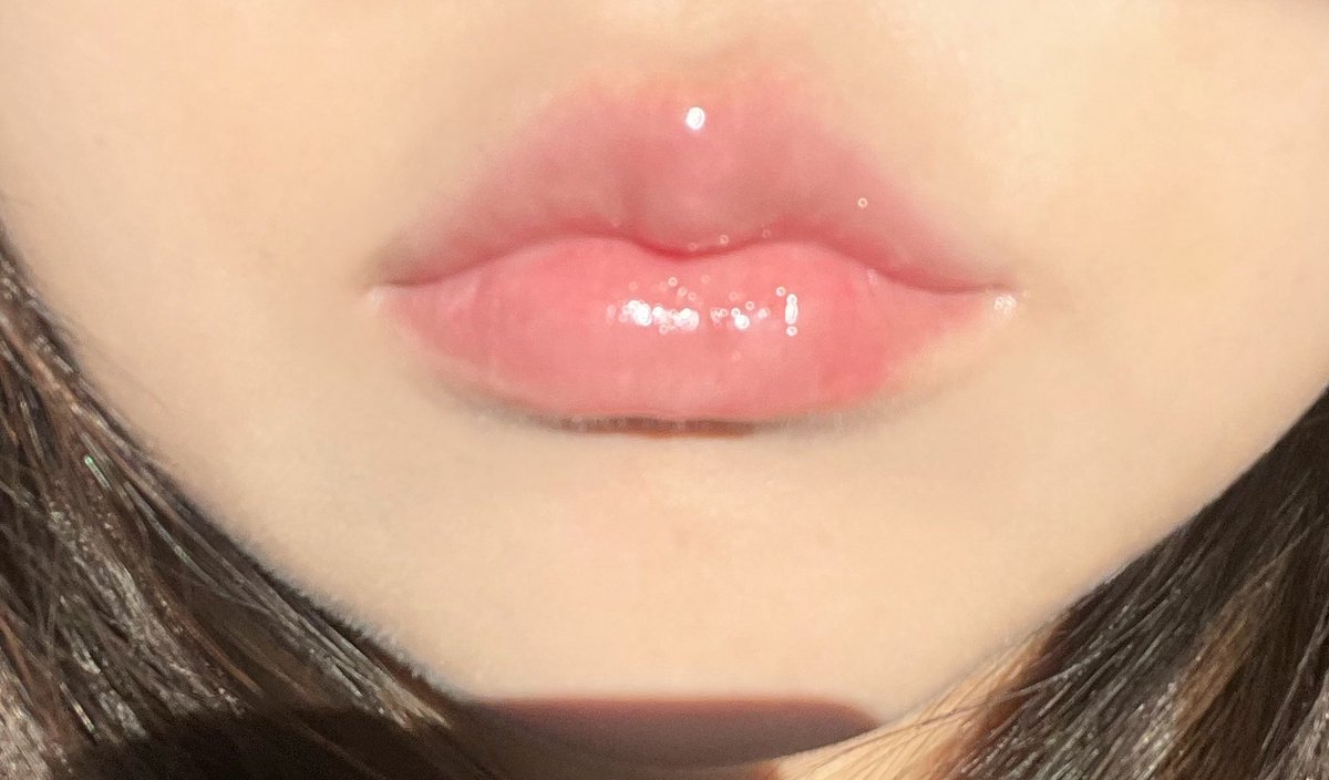 OTTD_ll's tweet photo. テイアクリニック@theiaclinic_jp でジュベルックして約２週間。やっぱ乾燥×毛穴にはジュベルック定期的に打つのが一番いい気がする。Derma：Codeが算出した適切な用量で施術を受けたからより効果が高く感じる💉

唇フィラーは腫れも引いて自然にボリュームでてまさに望んでた唇になって大満足🥹 https://t.co/IYPqLKPbgm